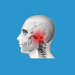 Disfunção temporomandibular e Dor Orofacial / Bruxismo